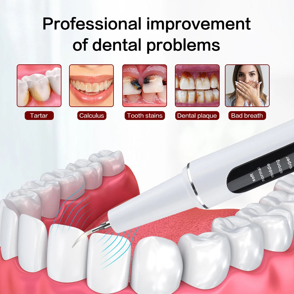 Xiaomi Youpin Ultrasonic Dental Scaler 2.8M/min High Frequency Vibrating Teeth Cleaner Plaque Calculus Tartar Stains Remover