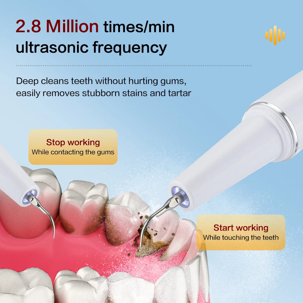Xiaomi Youpin Ultrasonic Dental Scaler 2.8M/min High Frequency Vibrating Teeth Cleaner Plaque Calculus Tartar Stains Remover