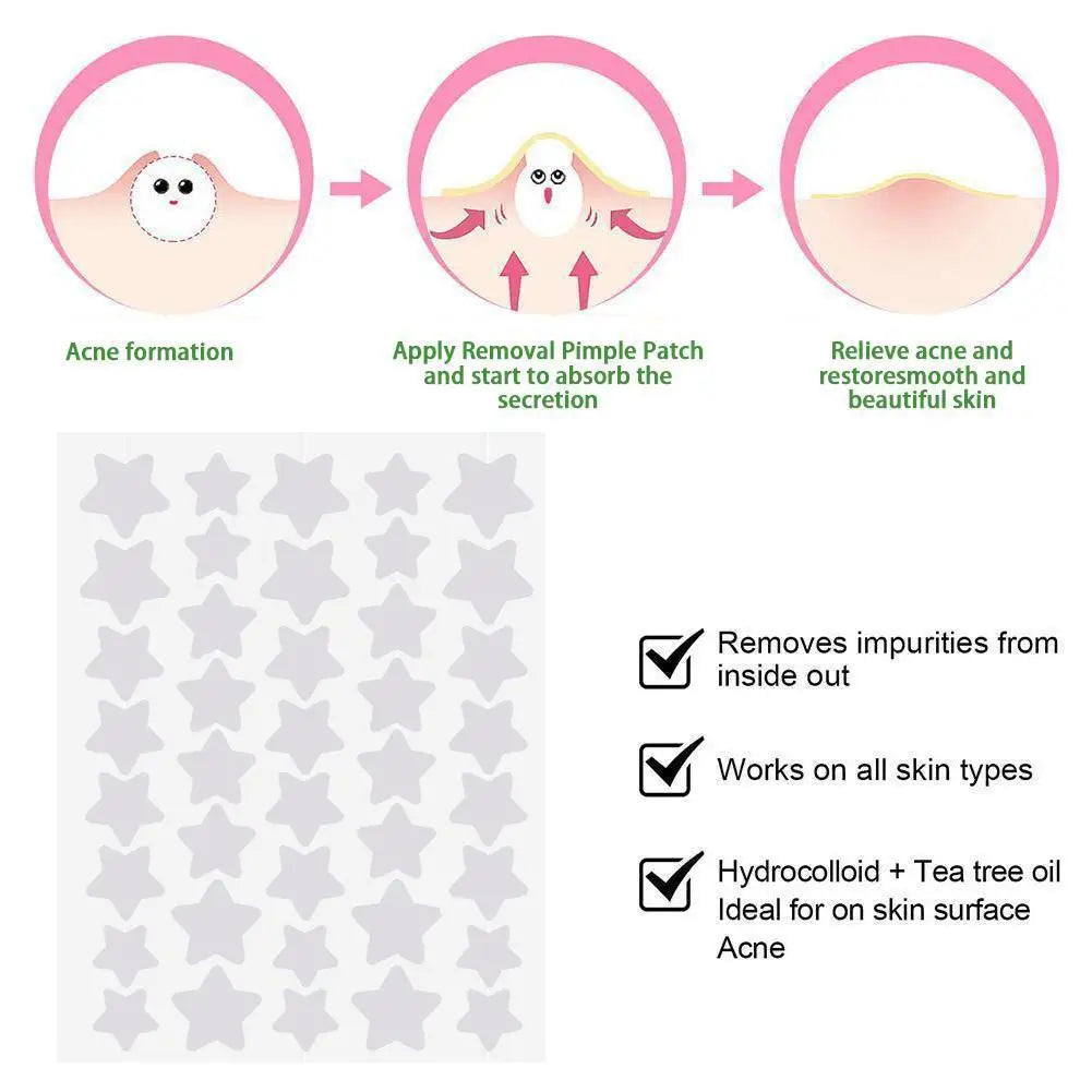 40pcs Star Shape Acne Patch Invisible Remove Blemish Stickers Pimple Cover Easy Apply Patches Face Treatment Skin Care