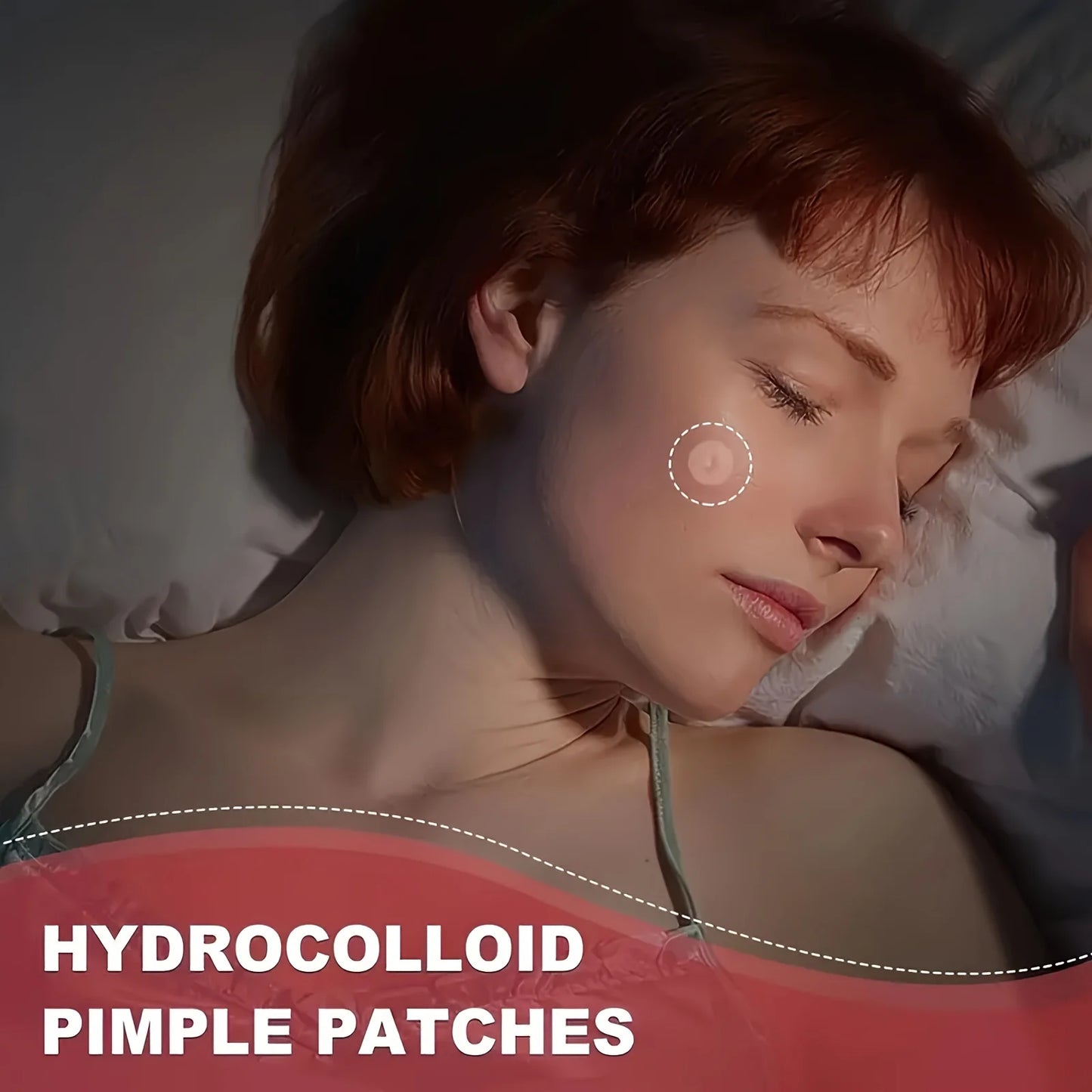 36 /360Patches Acne Treatment Patch, Absorbs Pimple And Acne, Hydrocolloid Acne Pimple Patch For Covering Zits And Blemishes.